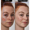 The INKEY List™ SuperSolutions 10% Azelaic Acid Serum 30ml - Image 4