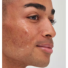 The INKEY List™ Tranexamic Acid Serum 30ml - Image 4